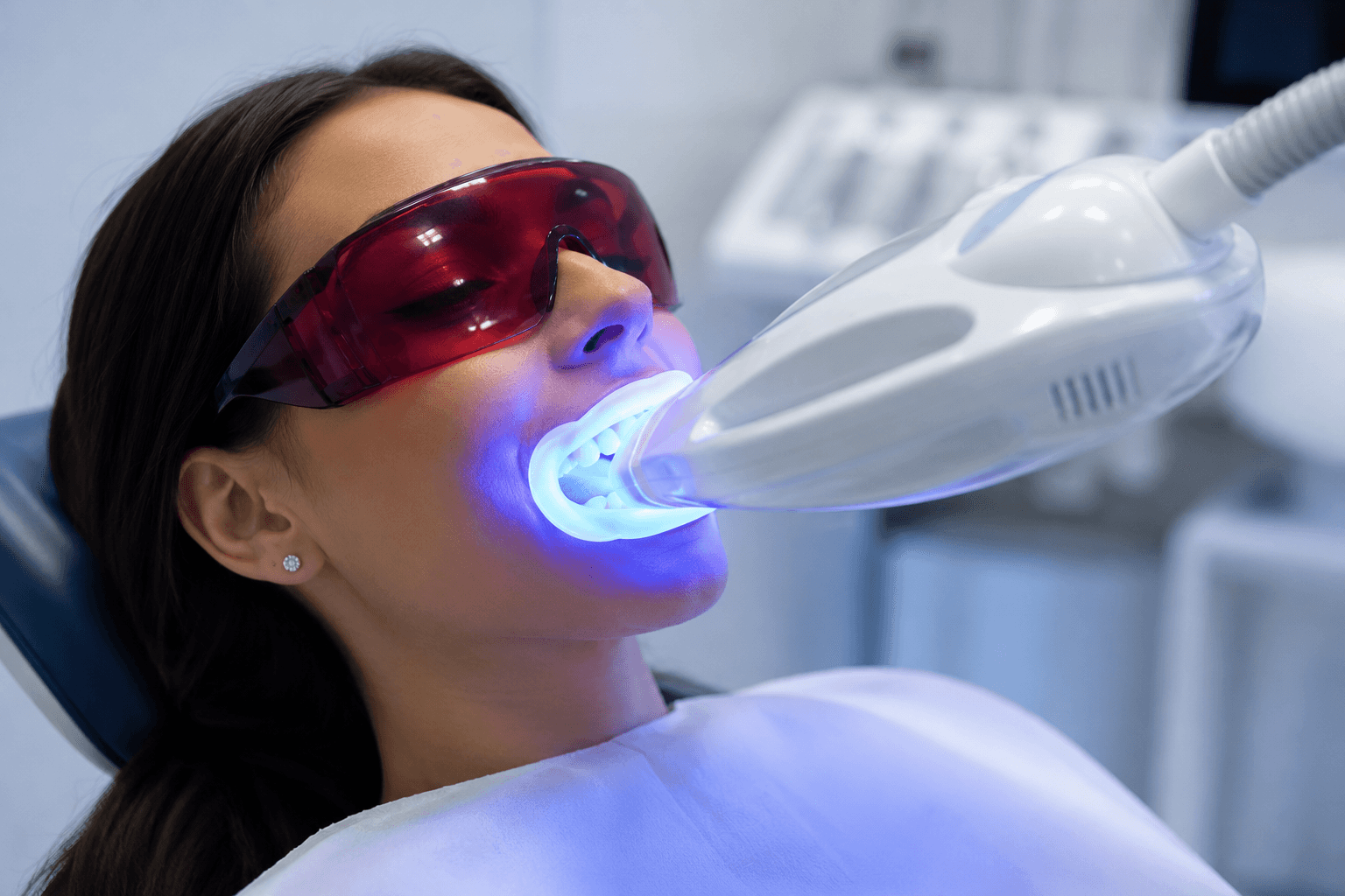 Blanchiment dentaire — Centre El Mostaine Dental