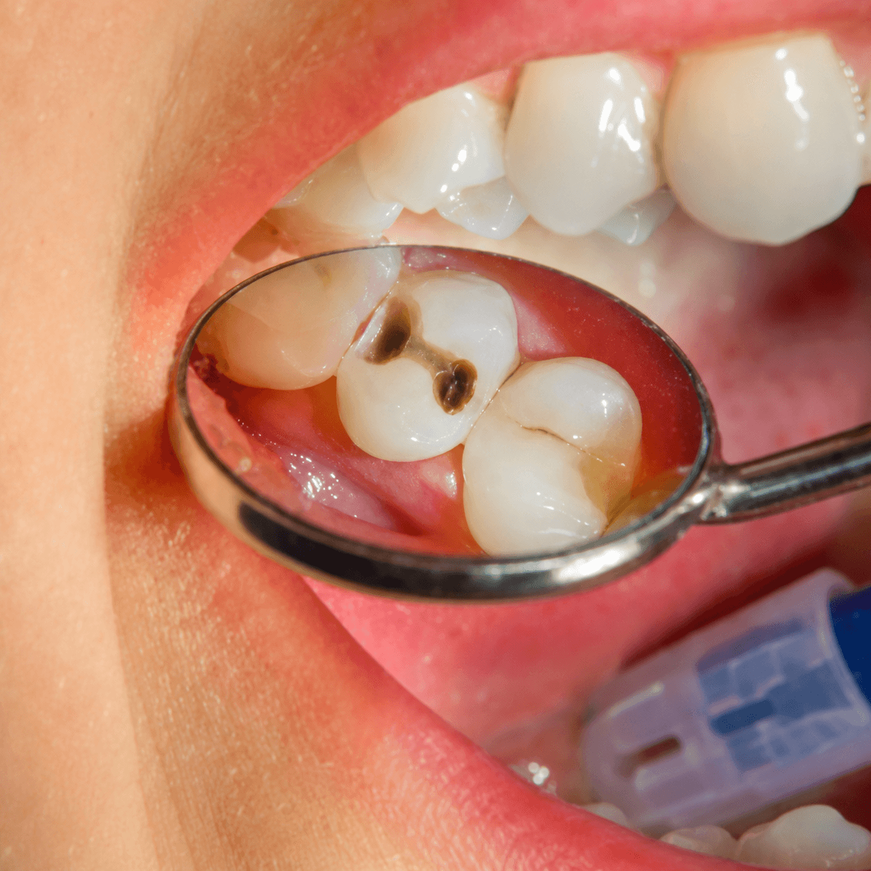 Soins dentaires — Centre El Mostaine Dental